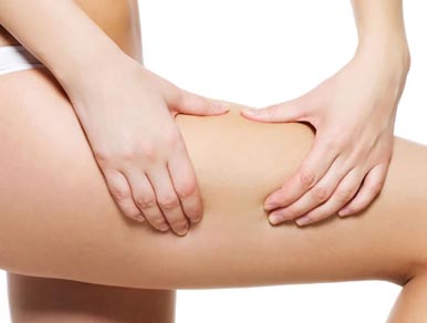 como acabar con la celulitis|tratamiento celulitis|celulitis|tratamiento imperium celulitis|tratamiento indiba celulitis|tratamiento zionic celulitis|combatir celulitis|tratamientos celulitis