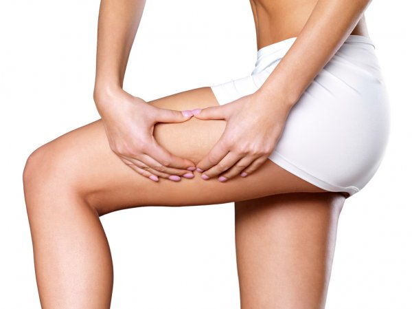 tratamientos para la celulitis||