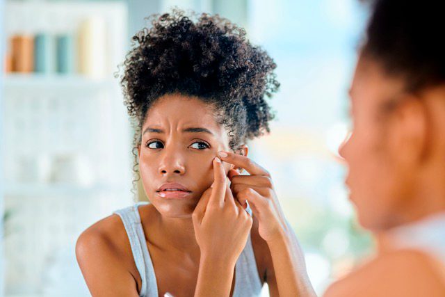 Acné adulto, como combatirlo|neoderma-y-beoxy-para-el-acne-adulto
