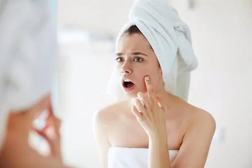 Tipos de imperfecciones que podemos encontrar en la piel